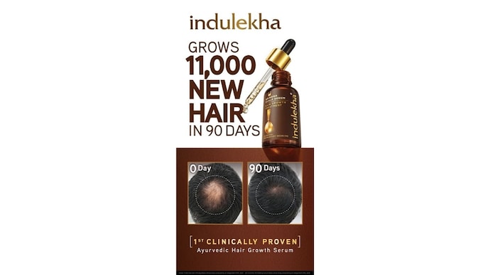 Clinical trials show the Ayurvedic hair growth serum grows over 11,000 new hair strands in 90 days while improving hair density and root strength.