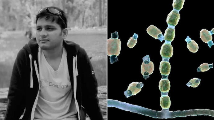 Indian tech professional in the US died of valley fever, a soil-borne disease. (Photo: gofundme.com/Getty Images) Indian tech professional in the US died of valley fever, a soil-borne disease.