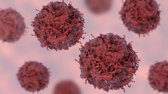 Lung cancer cell, computer illustration. Keywords * Lung cancer cell, computer illustration.
