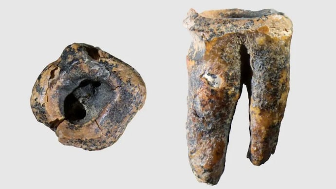 An image of the ancient tooth discovered in Siberia. (Photo: PLOS One) Neanderthals acted as dentists, treated teeth: 59,000-year-old tooth reveals