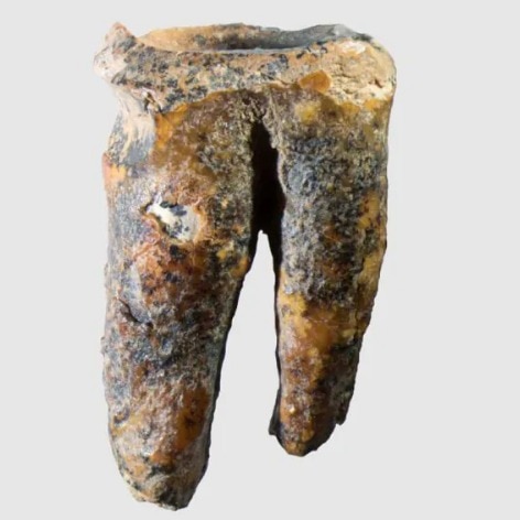 Neanderthals were dentists, treated teeth: 59,000-year-old tooth reveals