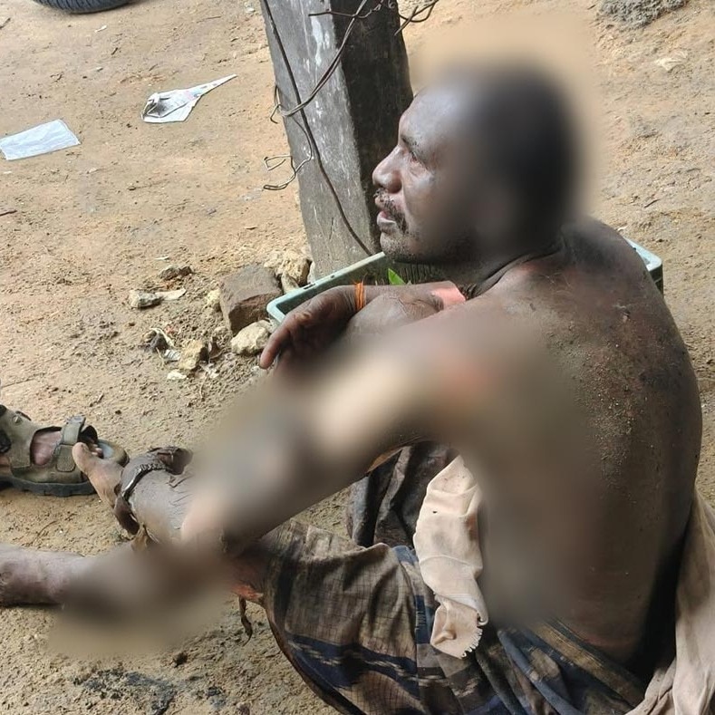 TVK worker attempts self-immolation over delay in Vijay becoming CM, suffers burns