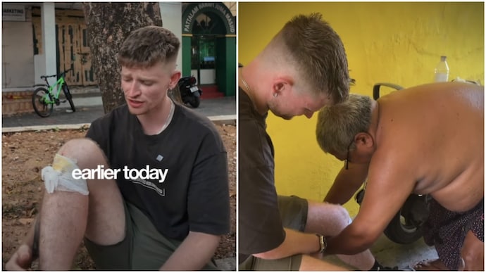 UK man praises Kerala locals who helped him with injury, says 'India is different' (Photos: @jack_ofalljourneys/Instagram) UK man praises Kerala locals who helped him with injury, says 'India is different'