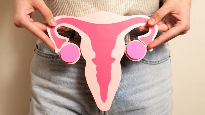 The symptoms of ovarian cancer are generally vague ओवरी कैंसर के शुरुआती लक्षण