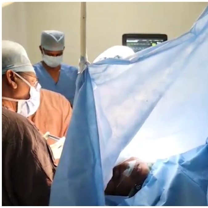 Andhra doctors perform brain surgery as patient watches Pawan Kalyan's OG