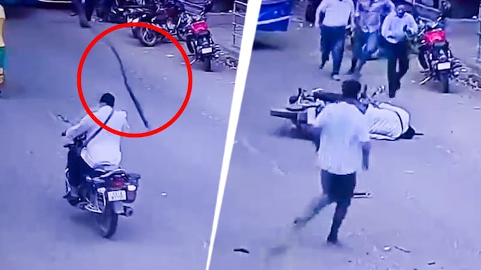 Doctors performed surgery on the man due to the severity of his injuries. Bengaluru accident