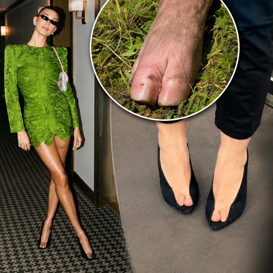 Pig feet, mushroom heels and more: Fashion’s weird shoe era is here