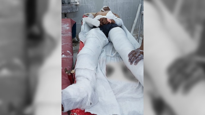 A BJP worker in Jhansi was allegedly attacked by relatives after his wife accused them of harassment.