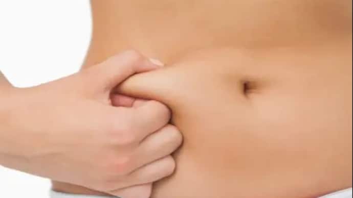Brown fat burns energy rather than storing it