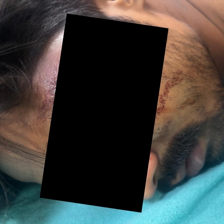 Gurugram society residents attack lift operator who rescued them, he loses an eye