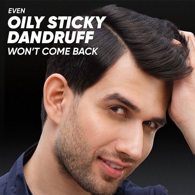 Dry Scalp or Dandruff? 6 Signs That Help You Tell the Difference