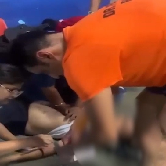 Man suffers heart attack during badminton match, off-duty doctors save his life