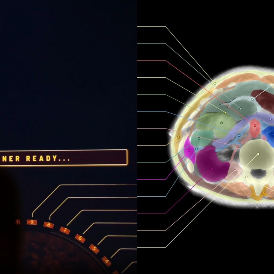 AI company Midjourney reveals full-body scanner, says MRI is complicated and old