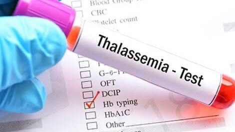 What happens if both parents carry the thalassemia gene? Doc