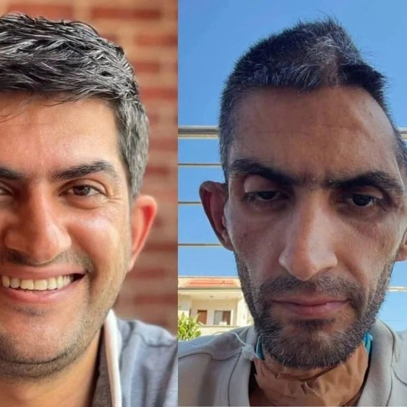 Two photos capture horror of Palestinian journalist's months in Israeli captivity
