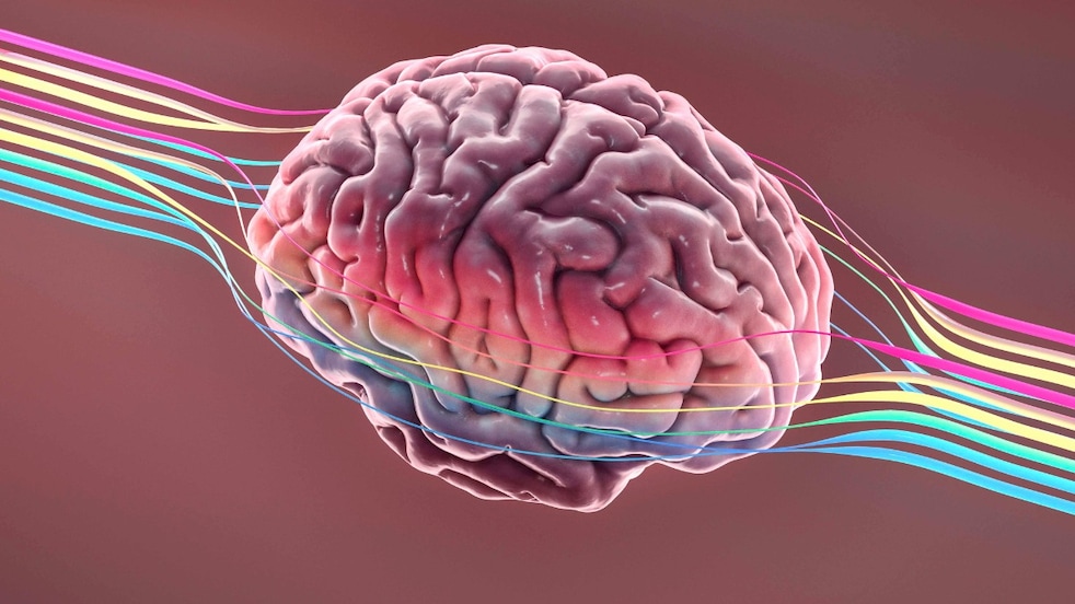 People documented with dementia have 3-5 times higher concentrations of microplastics and nanoplastics (MNPs) than normal individuals.