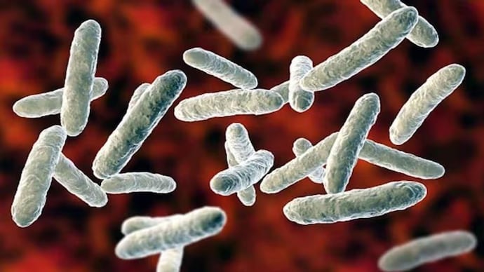 Shigella infection (Representative image)
