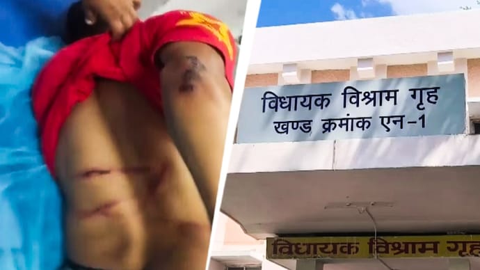 The accused's families alleged that the youths were subjected to custodial torture and were covered in injury marks.