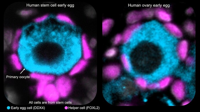 A company based in California has possibly created world's first human egg cells from stem cell A company based in California has possibly created world's first human egg cells from stem cell