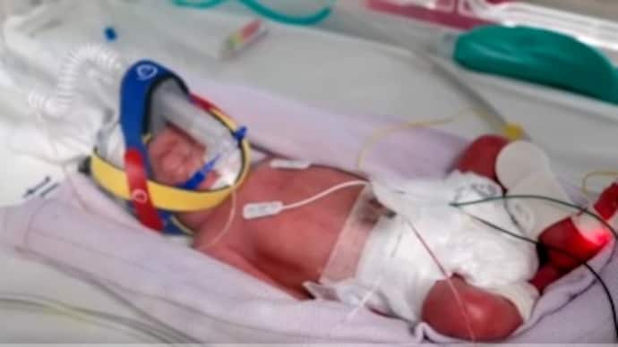 Australian woman delivers identical quadruplets in one-in-15-million case. (Image: @Reuters/Twitter) Australian woman delivers identical quadruplets in one-in-15-million case. (Image: @Reuters/Twitter)