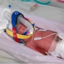 Mother of four gives birth to rare naturally conceived identical quadruplets