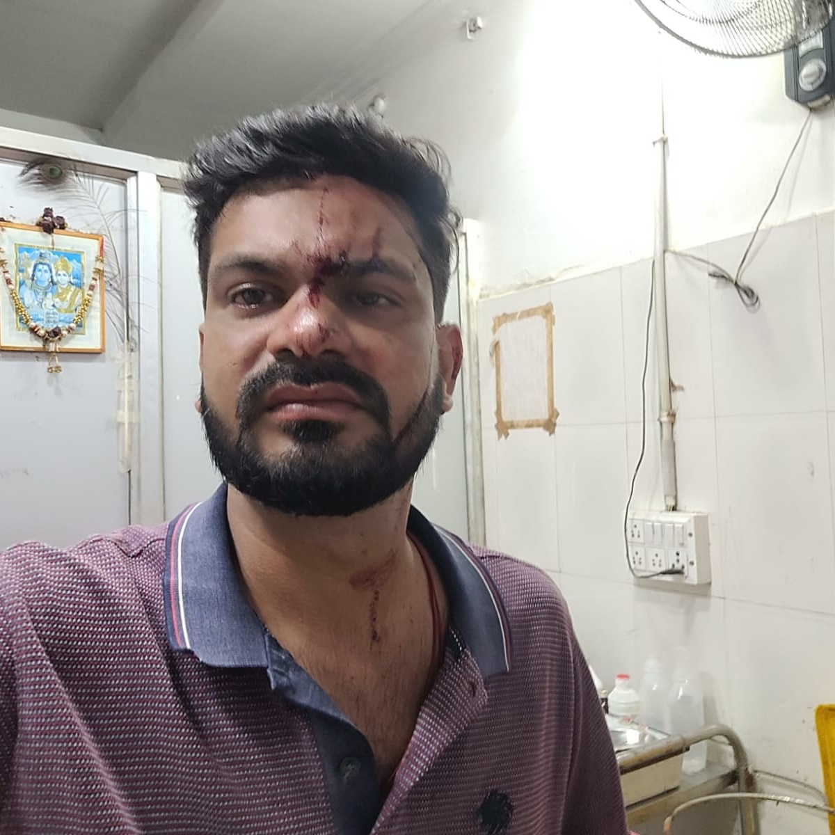 Odisha man dies days after wife hits him on head with phone during argument