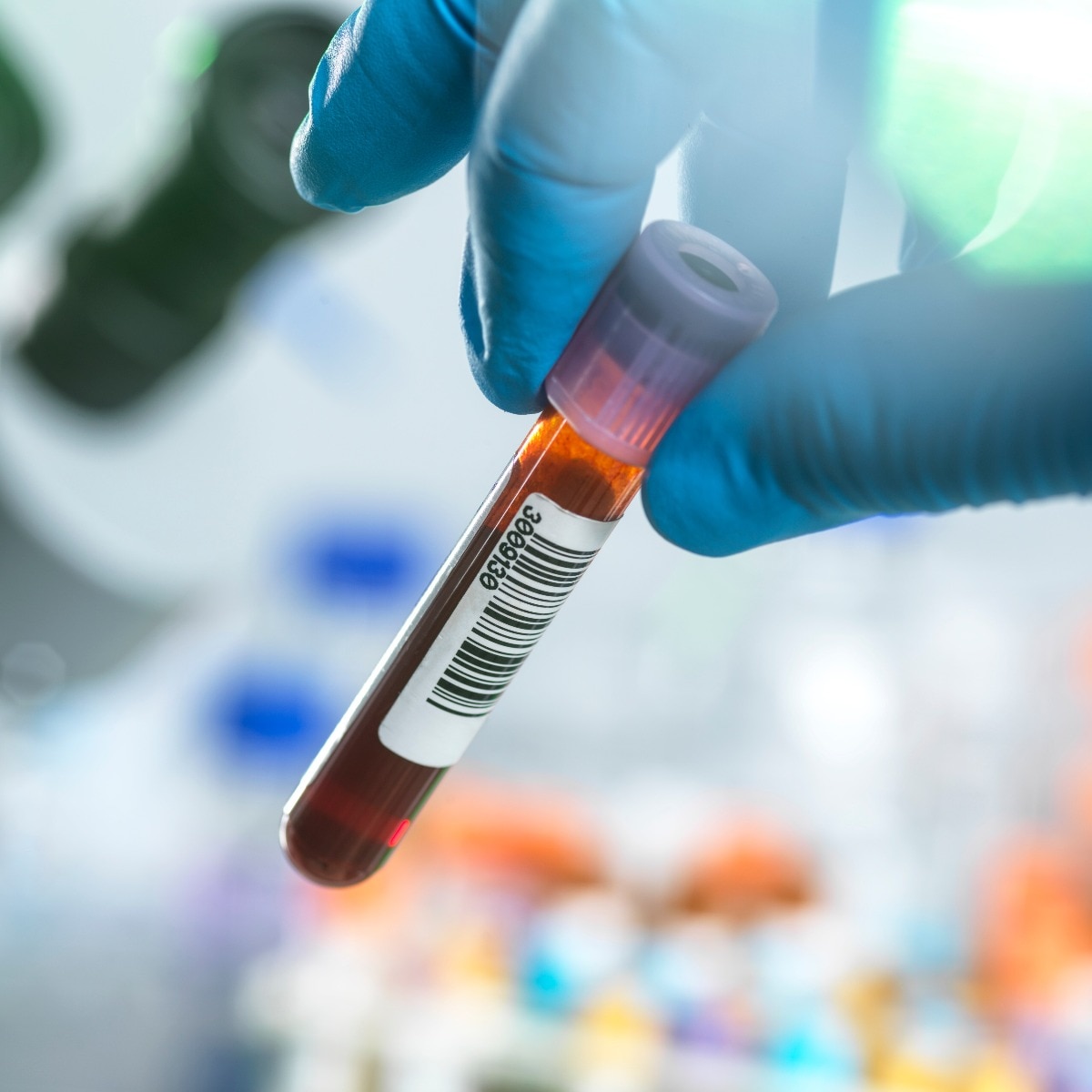 Single blood test to screen for 10 cancers debuts in India