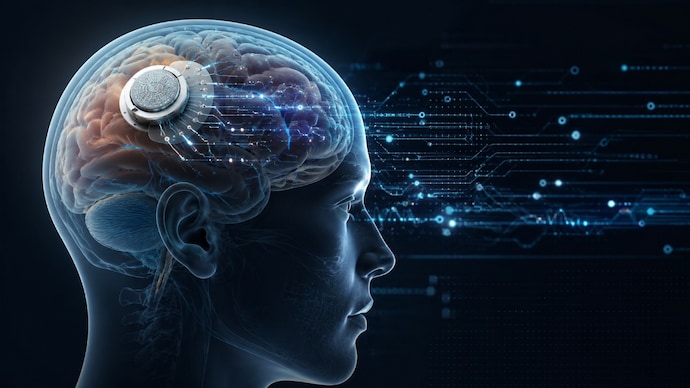 Brain implant surgery