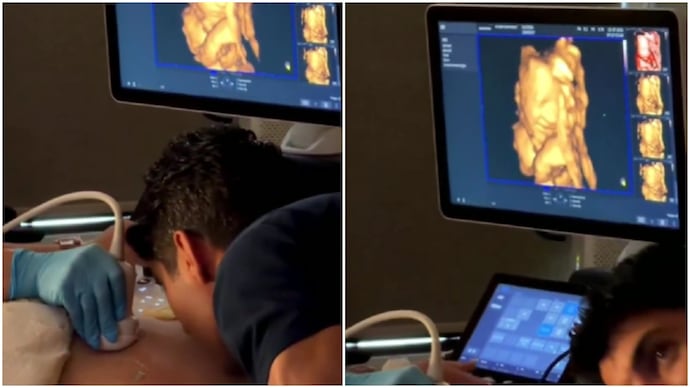 Canada man claims unborn daughter smiled as he spoke to her during wife's ultrasound