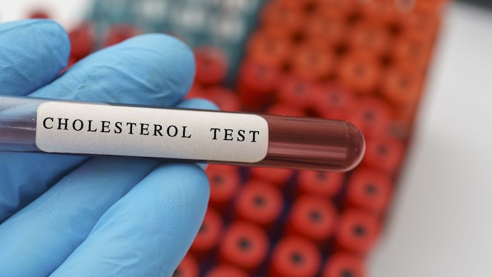Cholesterol blood test, conceptual image