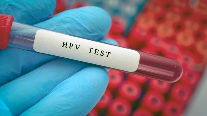 The test uses automated molecular technology to detect the DNA of eight high-risk HPV types responsible for most cervical cancer cases.