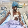 Lucknow labourer survives after 8.5-hour surgery to remove 4 iron rods Lucknow labourer survives after 8.5-hour surgery to remove 4 iron rods