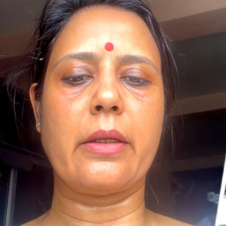 Now, Mahua Moitra targeted with eggs, brinjals. MP shares Facebook Live