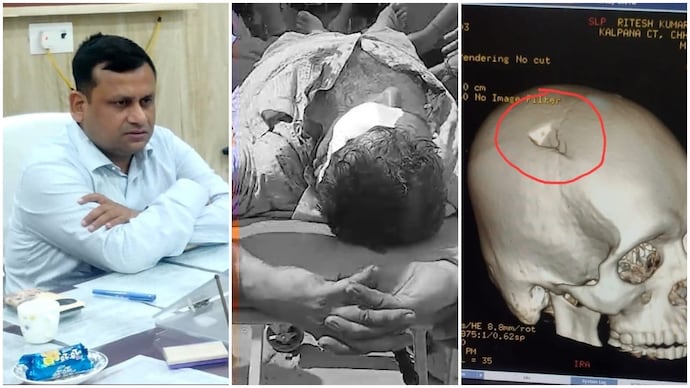 Officer Ritesh Kumar Singh suffered critical head injuries and underwent surgery after being struck by a cast iron weight.