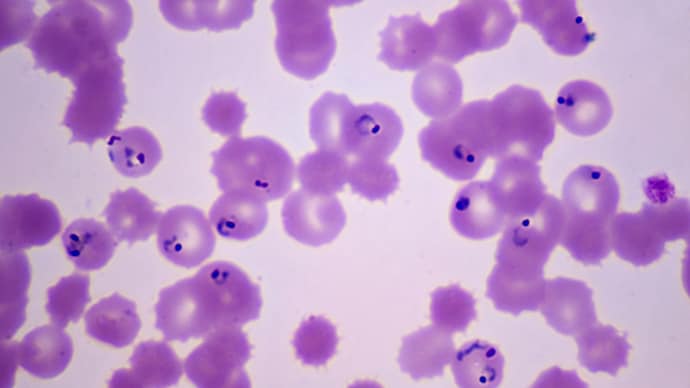 The illness is caused by the microscopic parasite Cyclospora