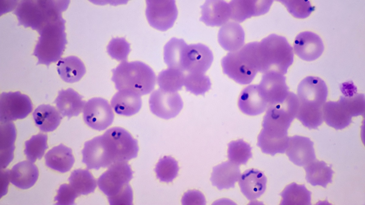 cyclospora