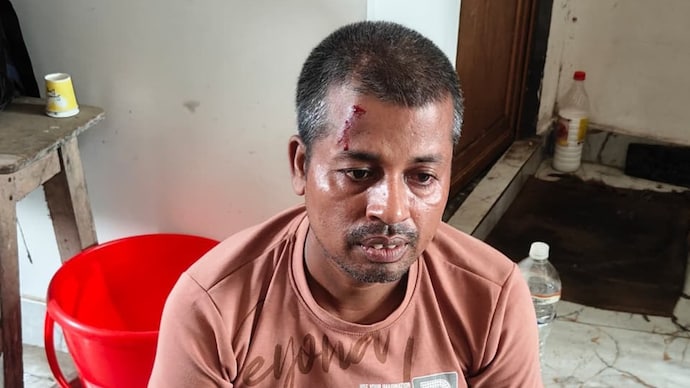 Police said Mondal snatched a police officer's weapon just before the crime scene reconstruction, fired a shot at the team and tried to escape, prompting police to open fire and injure him.