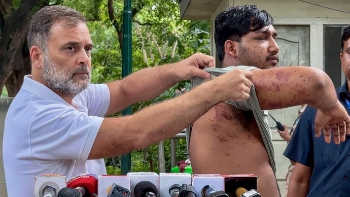 Protesters injured at the CJP march on July 20 have put pellet guns back in the spotlight. A less-lethal round is engineered to stop at the skin. A pellet is engineered to go through it. (Photo: PTI)