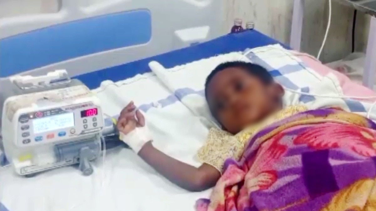Balaghat child deaths raise measles, malaria and care questions