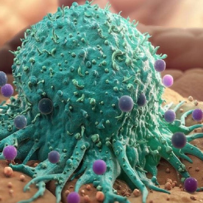 Immunotherapy vs chemotherapy: Why cancer treatment is not a simple choice