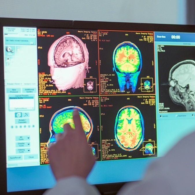 Human brain is not a single organ. New discovery could rewrite medicine