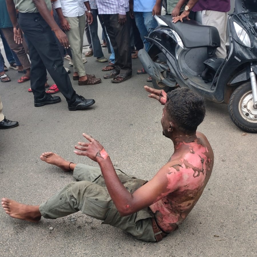 Mysuru man pours petrol on himself after rejection, tries to hug woman