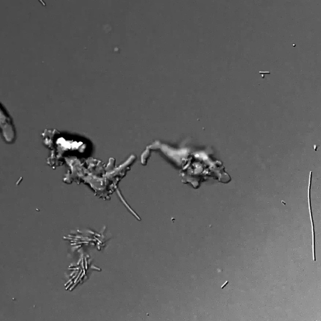 Could humans survive 65°C temperature? An amoeba just showed it can