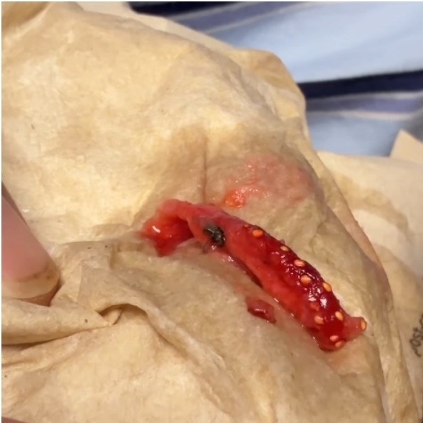 Delhi content creator finds dead fly in Starbucks drink. Company says sorry