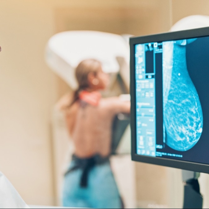 AIIMS mammography AI moves closer to breast cancer screening use