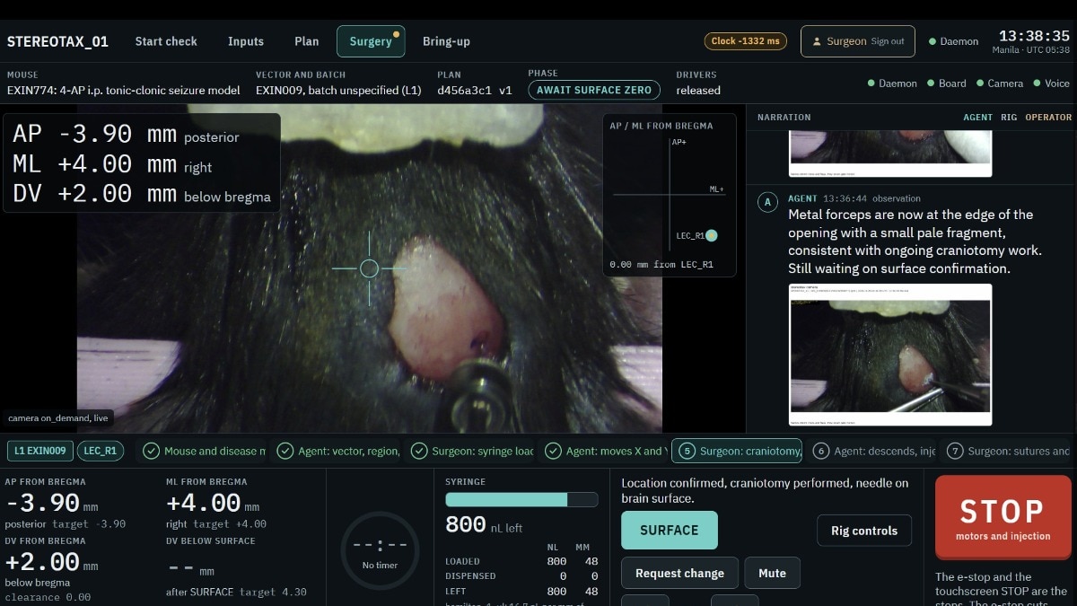 An AI agent just performed brain surgery. Here's how it went