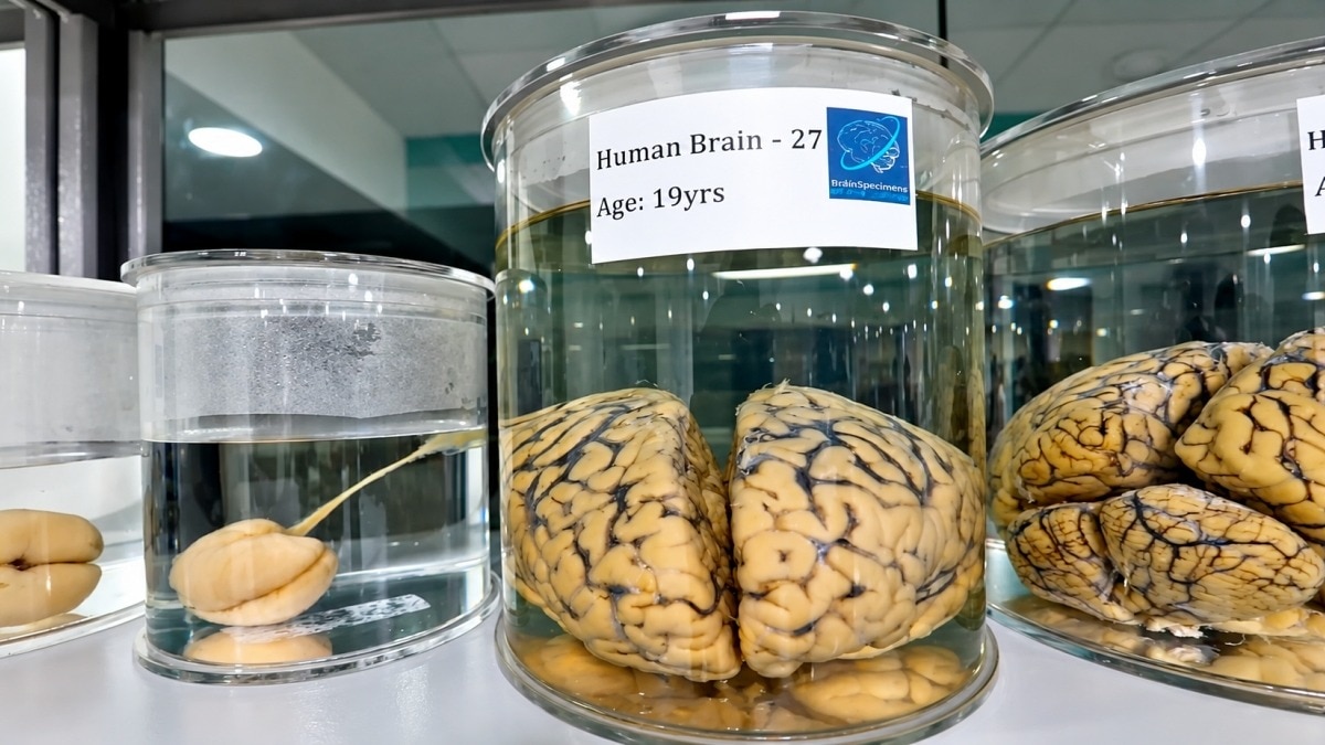 IIT-Madras wants to zoom deep inside human brain. PM tasks them to create its 3D map