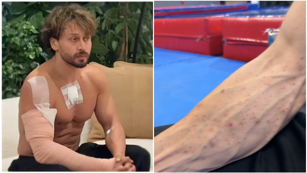 Tiger Shroff's team shares video of actor's burn marks after firing attack