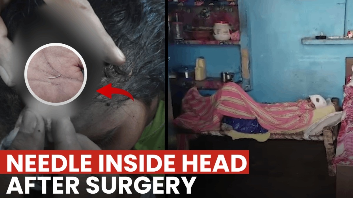 Doctor at UP's Hapur hospital forgets surgical needle inside woman's head