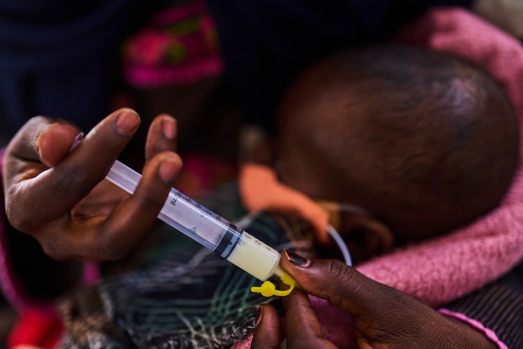A mother feeds baby formula to her son, who is being treated for malnutrition. (Photo: AP)